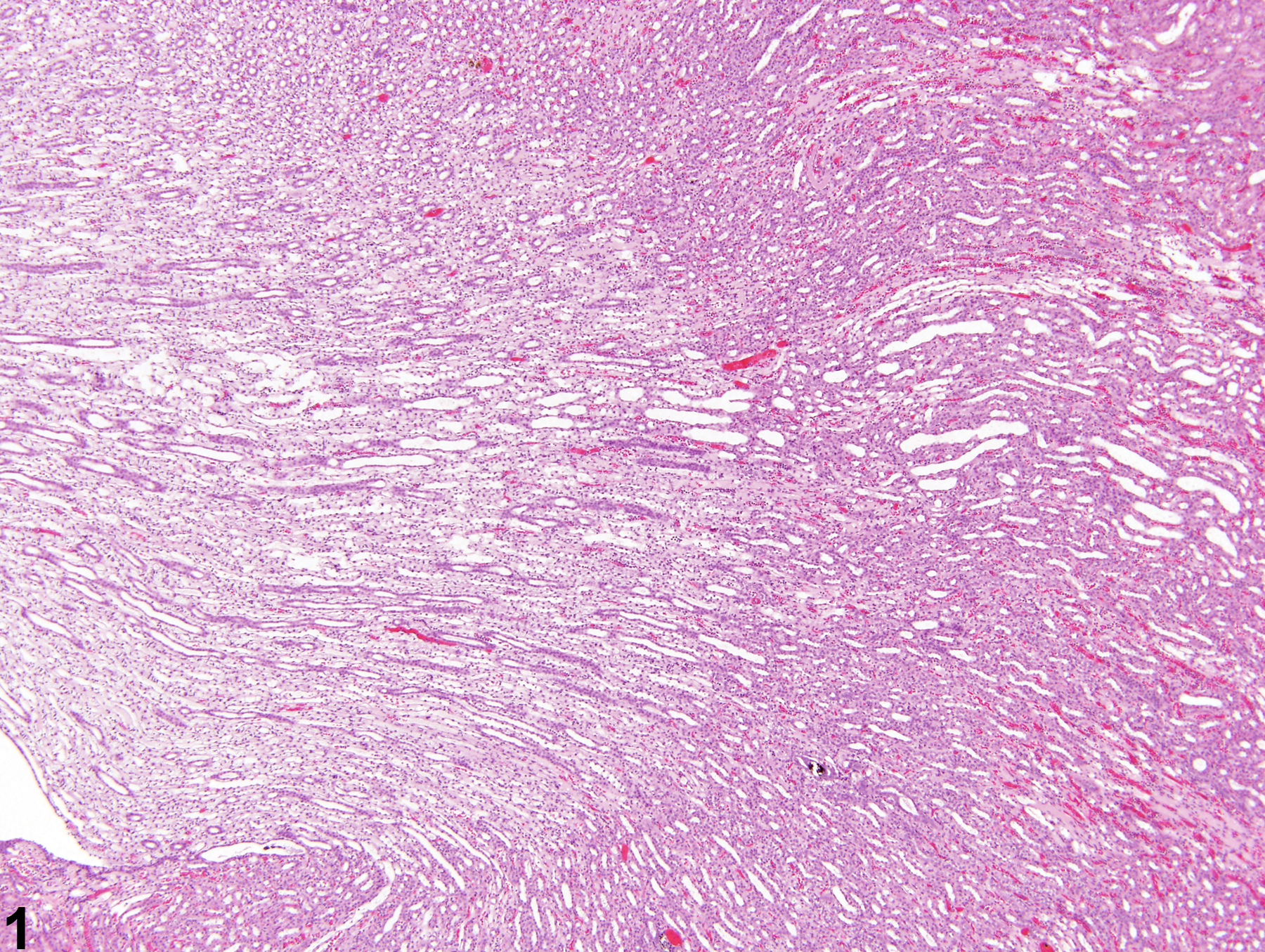 Image of nephropathy, obstructive in the kidney from a female F344/N rat in a chronic study