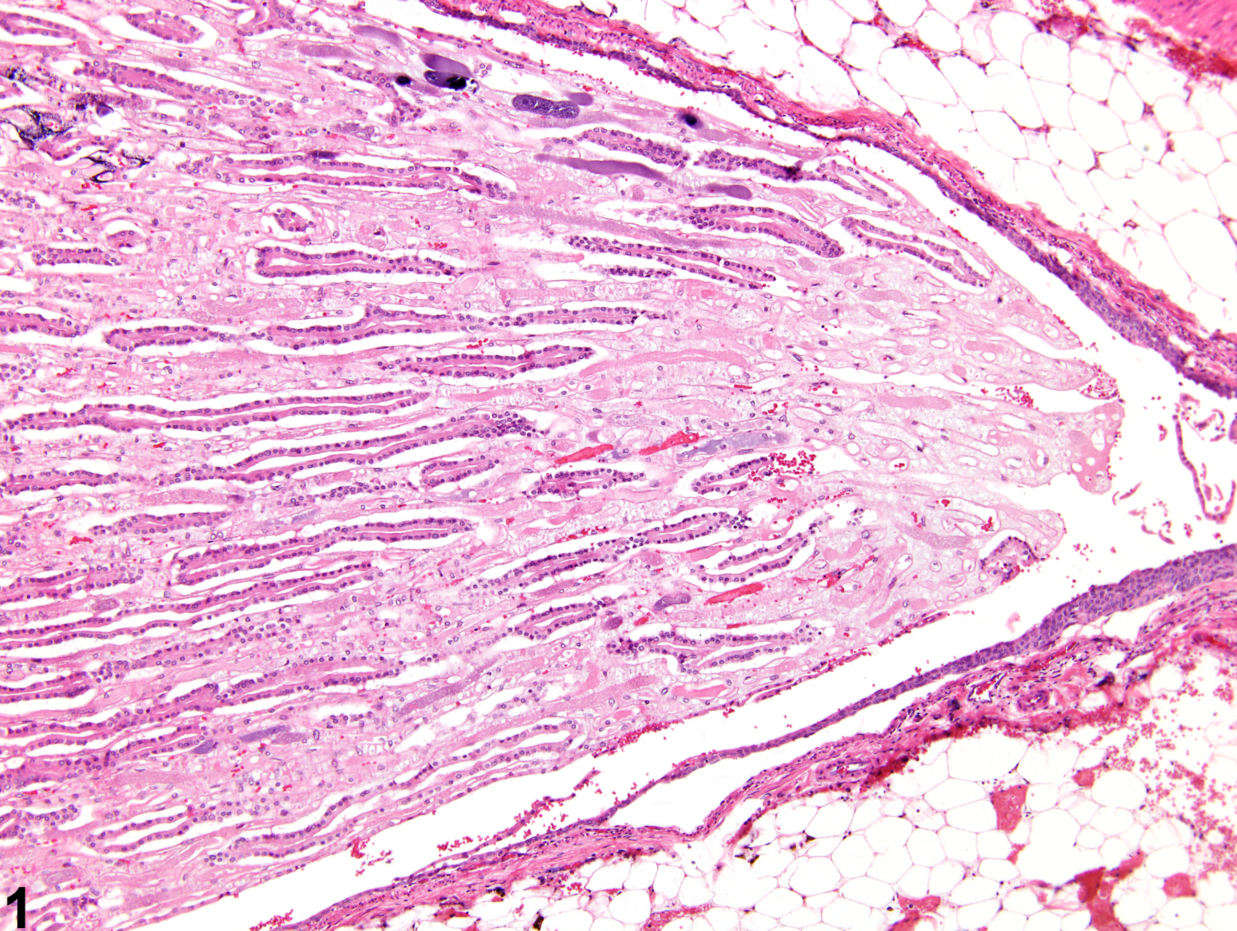 Image of papilla necrosis in the kidney from a male F344/N rat in a chronic study