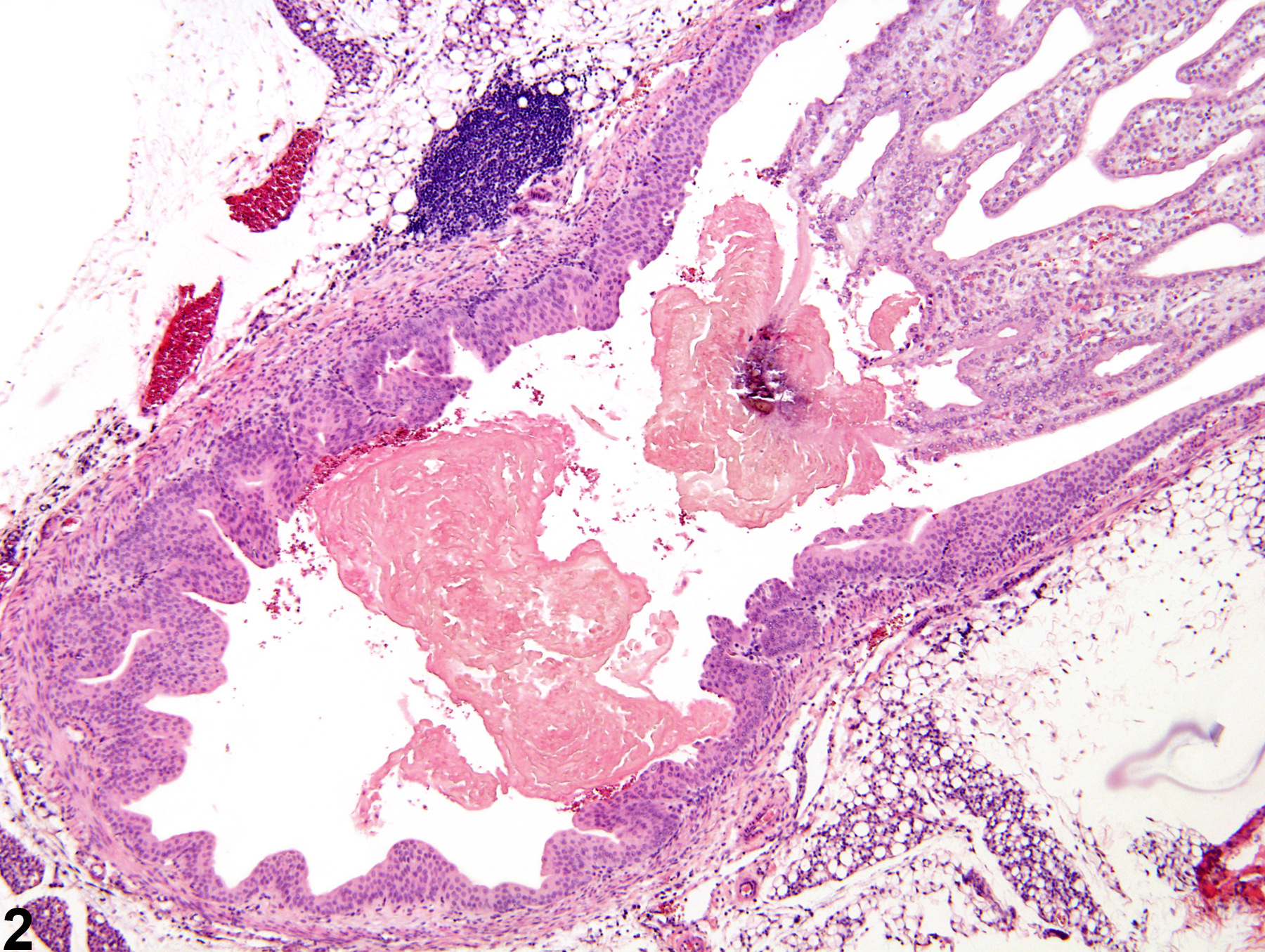 Image of papilla necrosis in the kidney from a male F344/N rat in a subchronic study