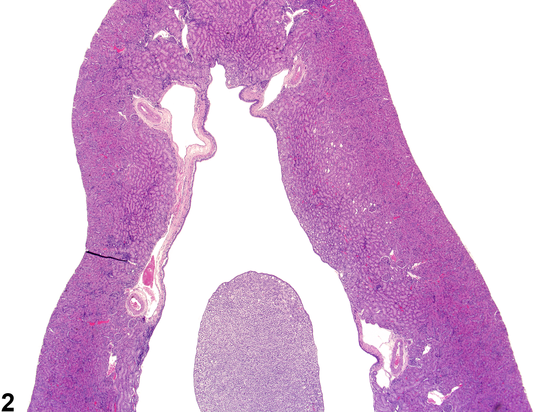 Image of renal pelvis dilation in the kidney from a male  rat in a subchronic study