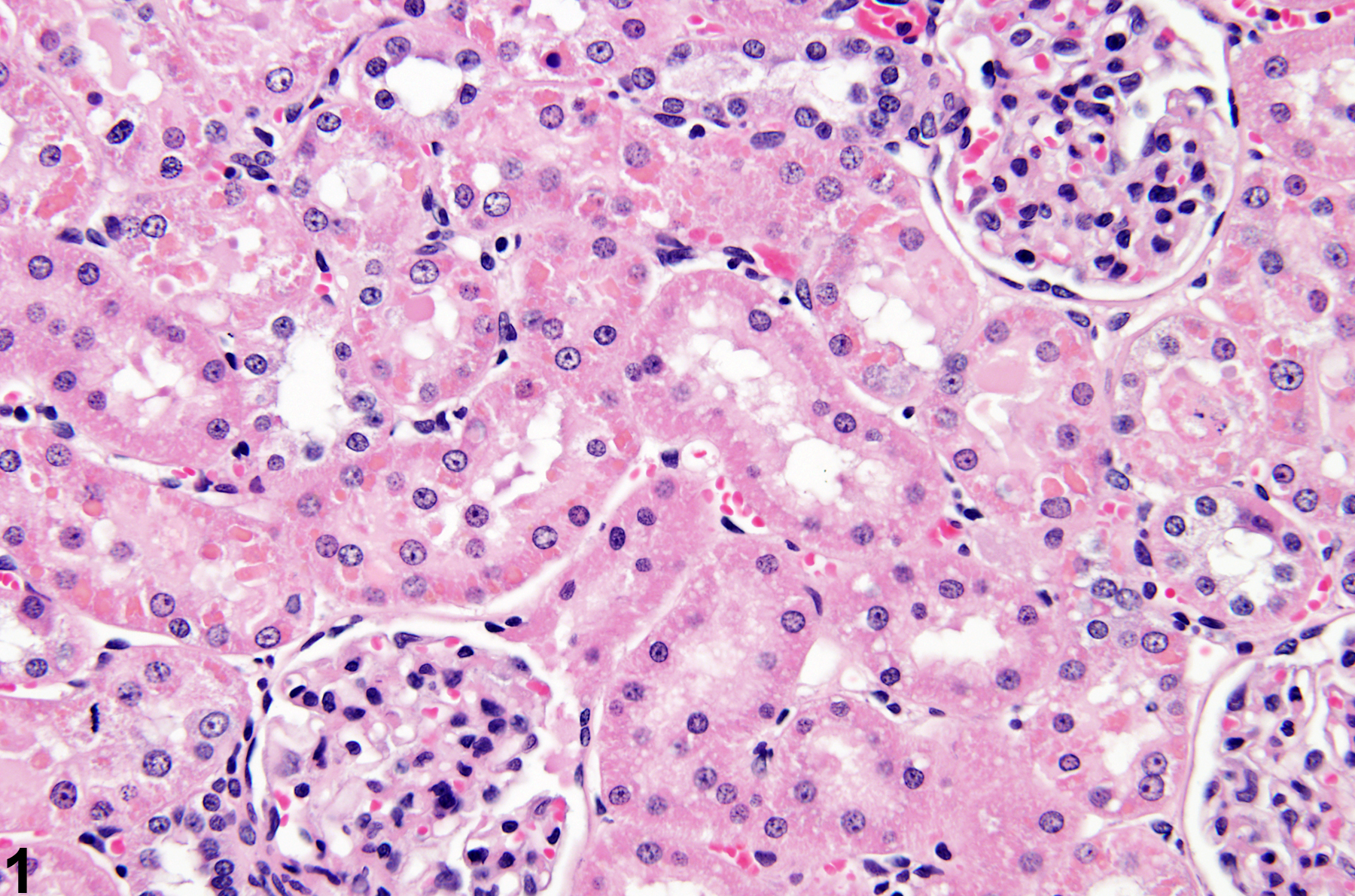 Image of renal tubule accumulation hyaline droplet in the kidney from a male F344/N rat in a subchronic study