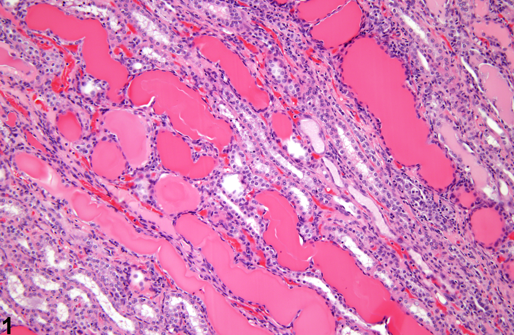 Image of renal tubule cast in the kidney from a male F344/N rat in a chronic study