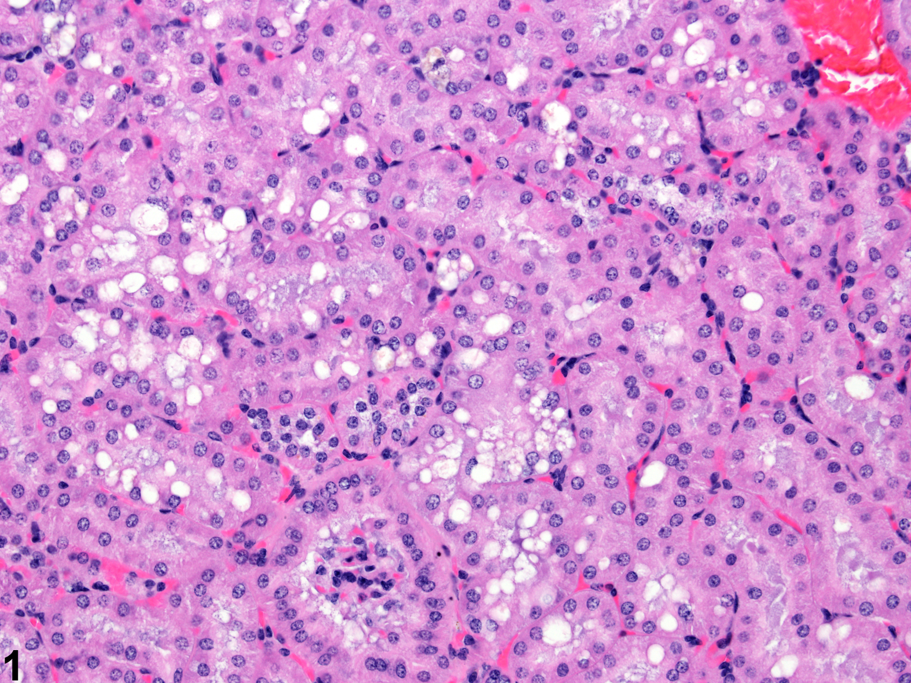 Image of renal tubule cytoplasmic vacuoles (normal) in the kidney from a male B6C3F1 mouse in a chronic study