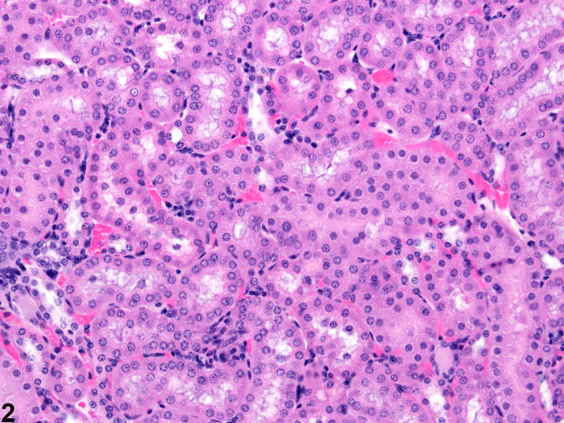 Image of cytoplasmic alteration in the kidney from a male B6C3F1 mouse in a chronic study