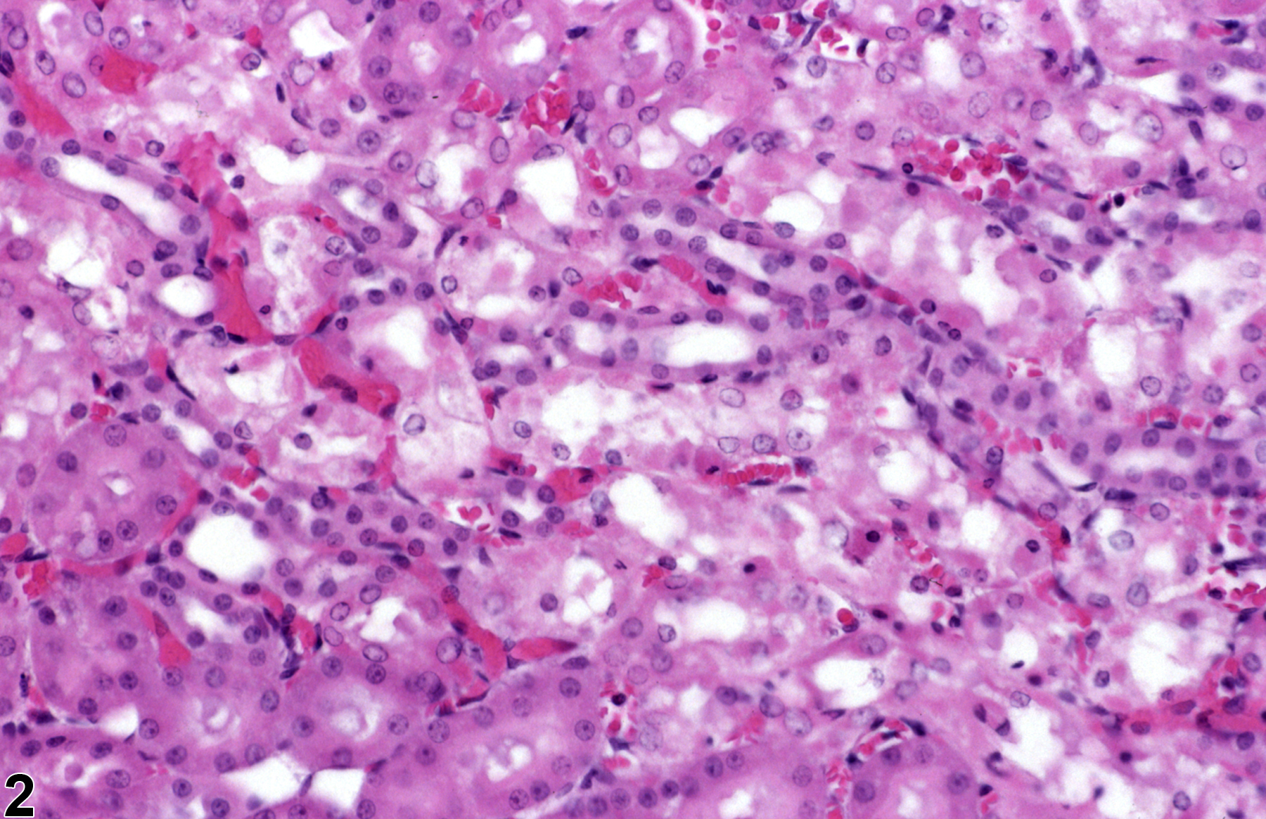 Image of renal tubule degeneration in the kidney from a female F344/N rat in a subchronic study