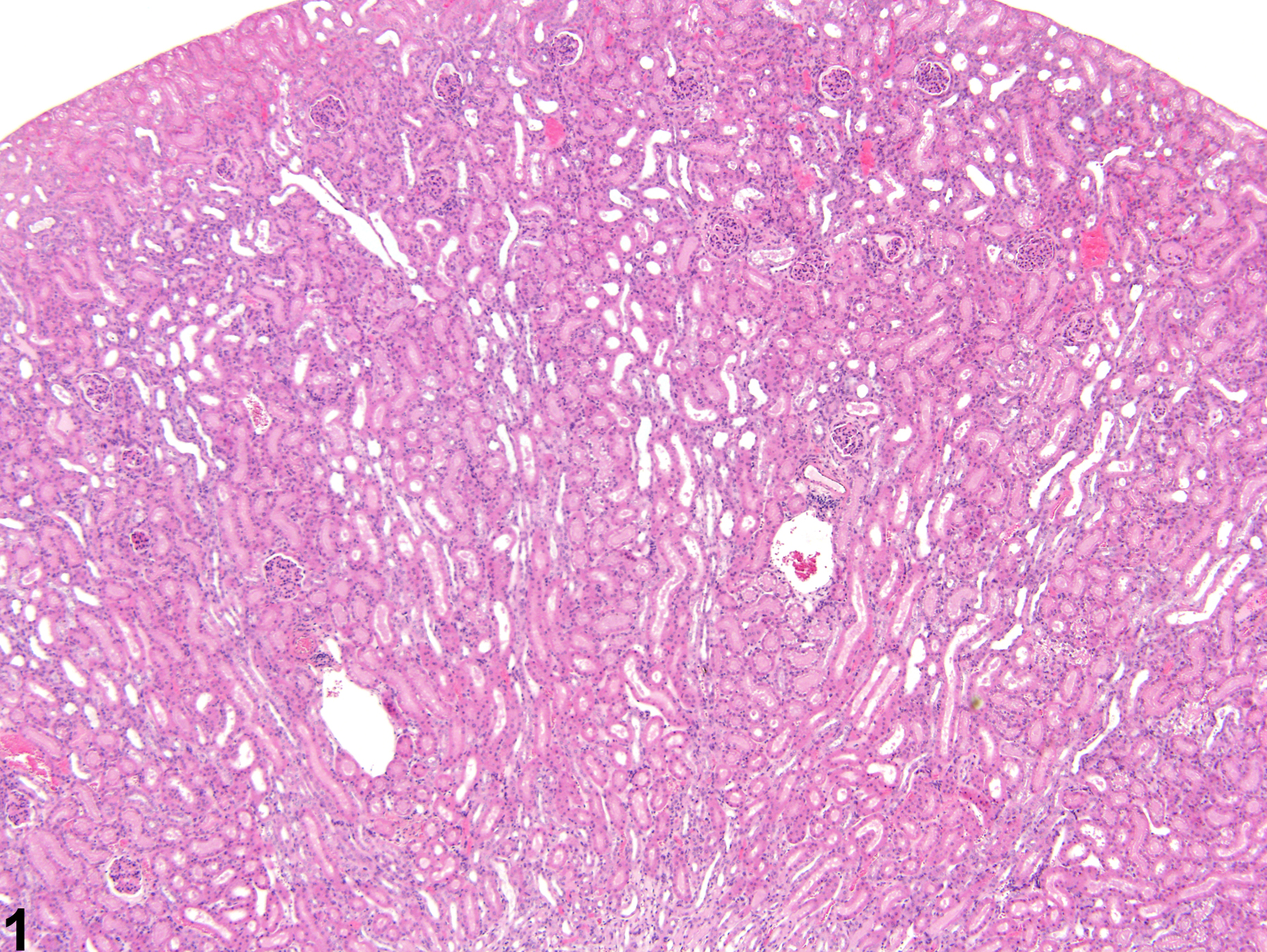 Image of renal tubule dilation in the kidney from a male B6C3F1 mouse in a chronic study