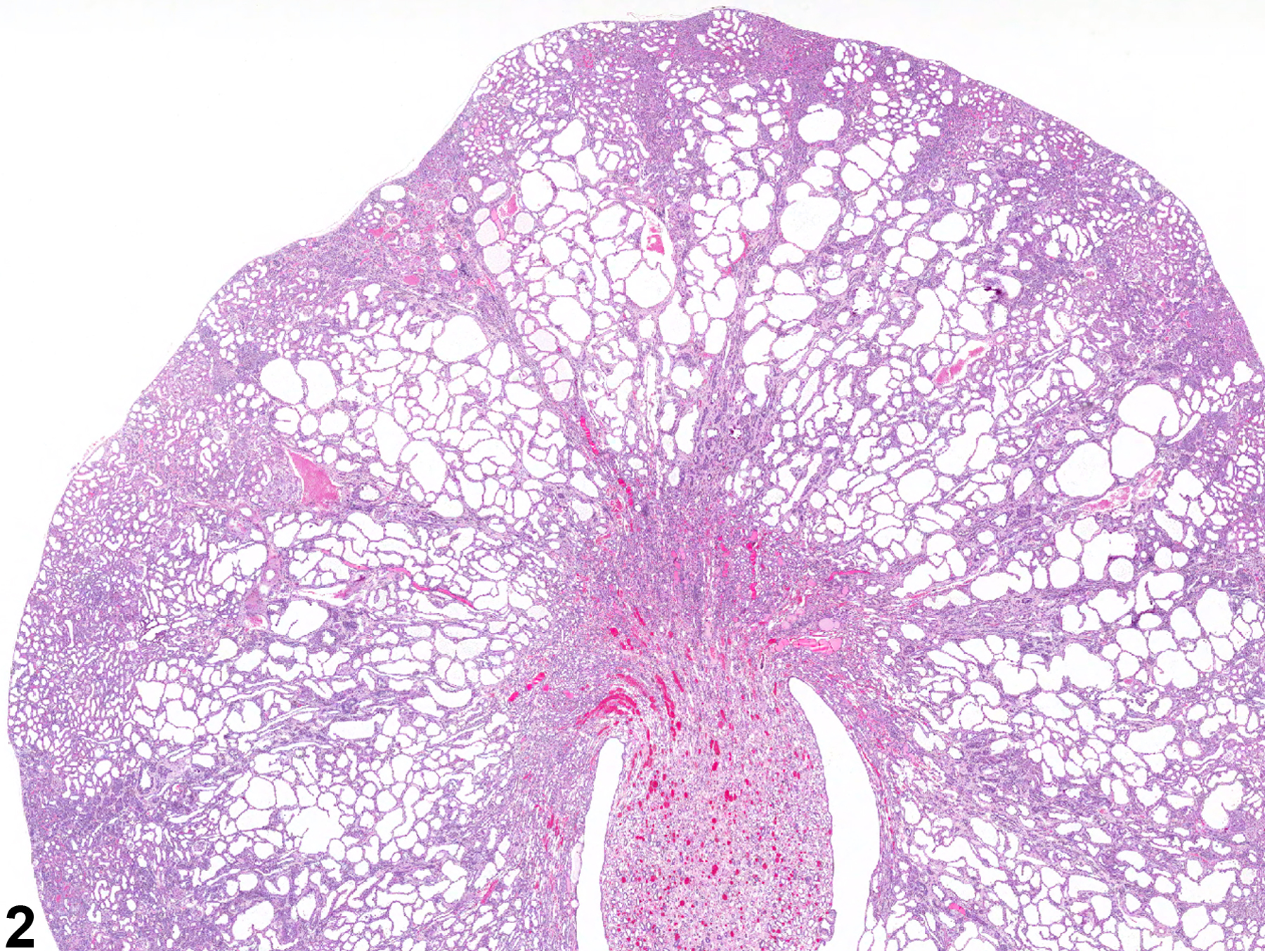 Image of renal tubule dilation in the kidney from a male F344/N rat in a chronic study