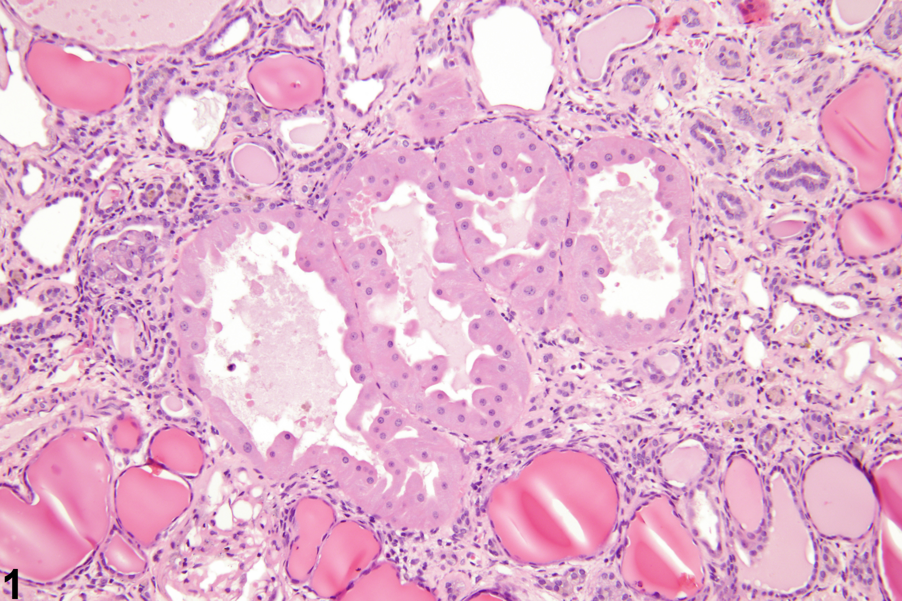 Image of renal tubule hypertrophy in the kidney from a male F344/N rat in a chronic study