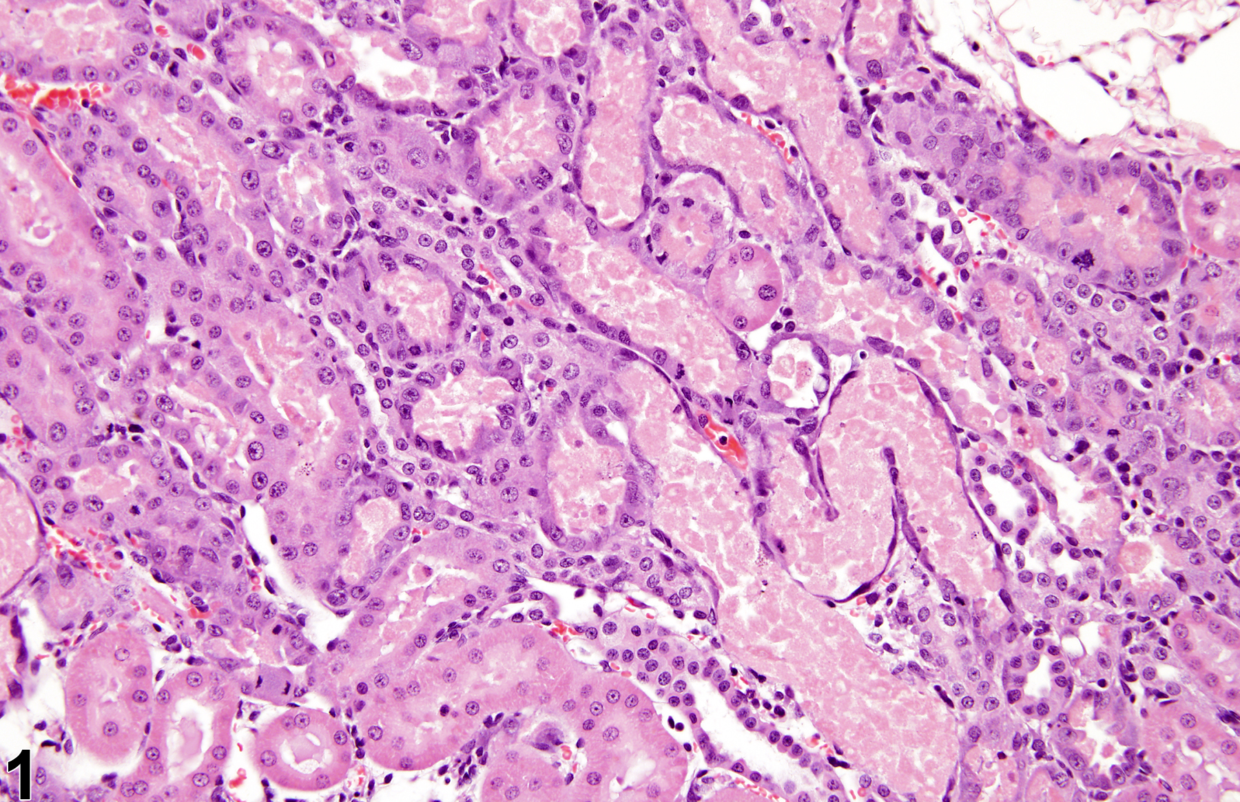 Image of renal tubule regeneration in the kidney from a male rat in an acute study