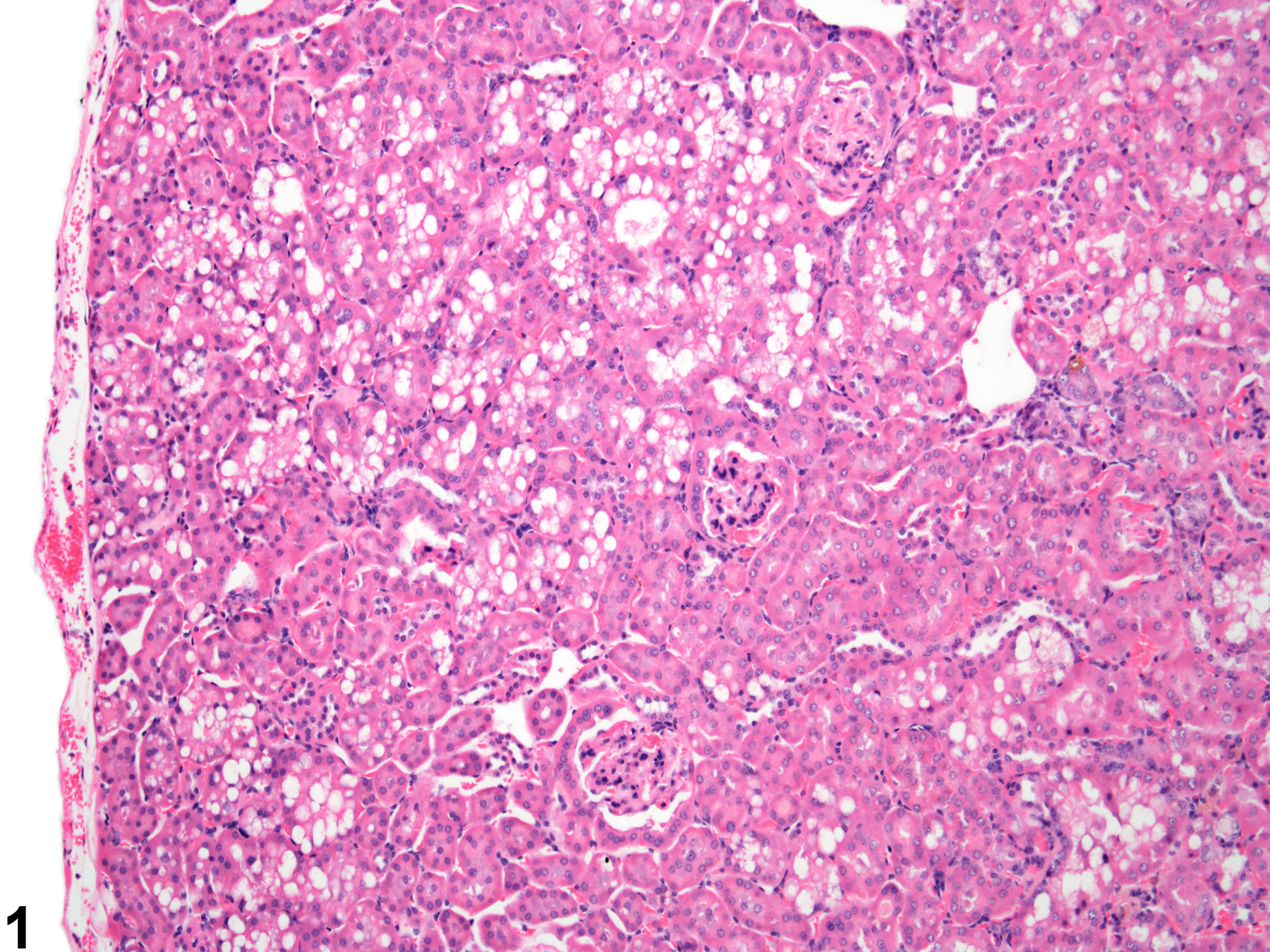 Image of renal tubule vauolation cytoplasmic in the kidney from a male B6C3F1 mouse in a chronic study