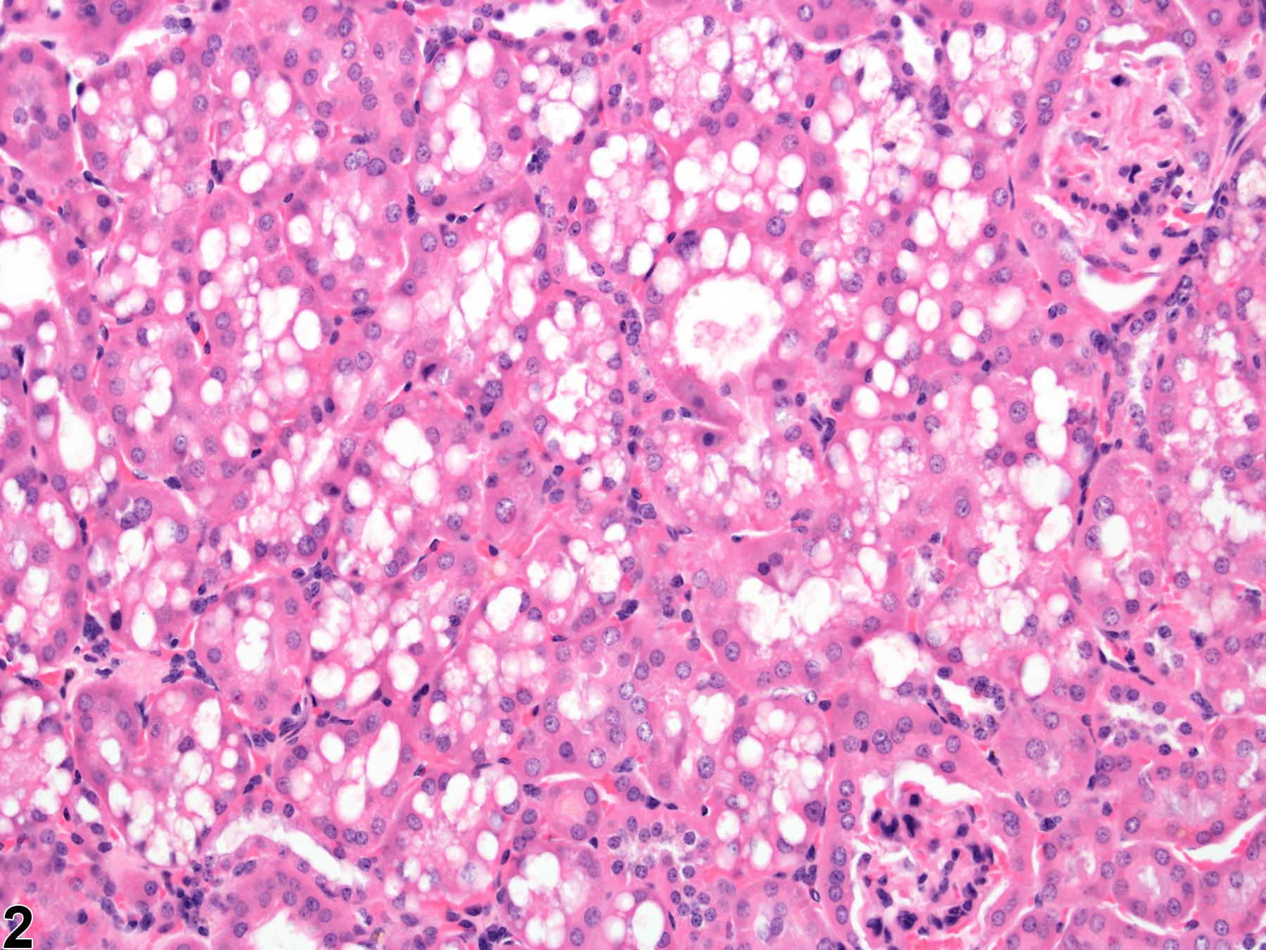 Image of renal tubule vauolation cytoplasmic in the kidney from a male B6C3F1 mouse in a chronic study