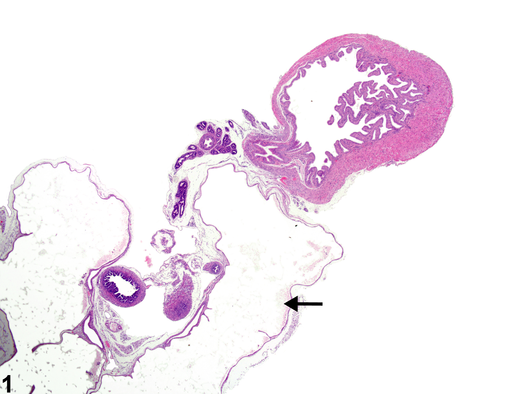 Image of dilation in the ureter from a male mouse