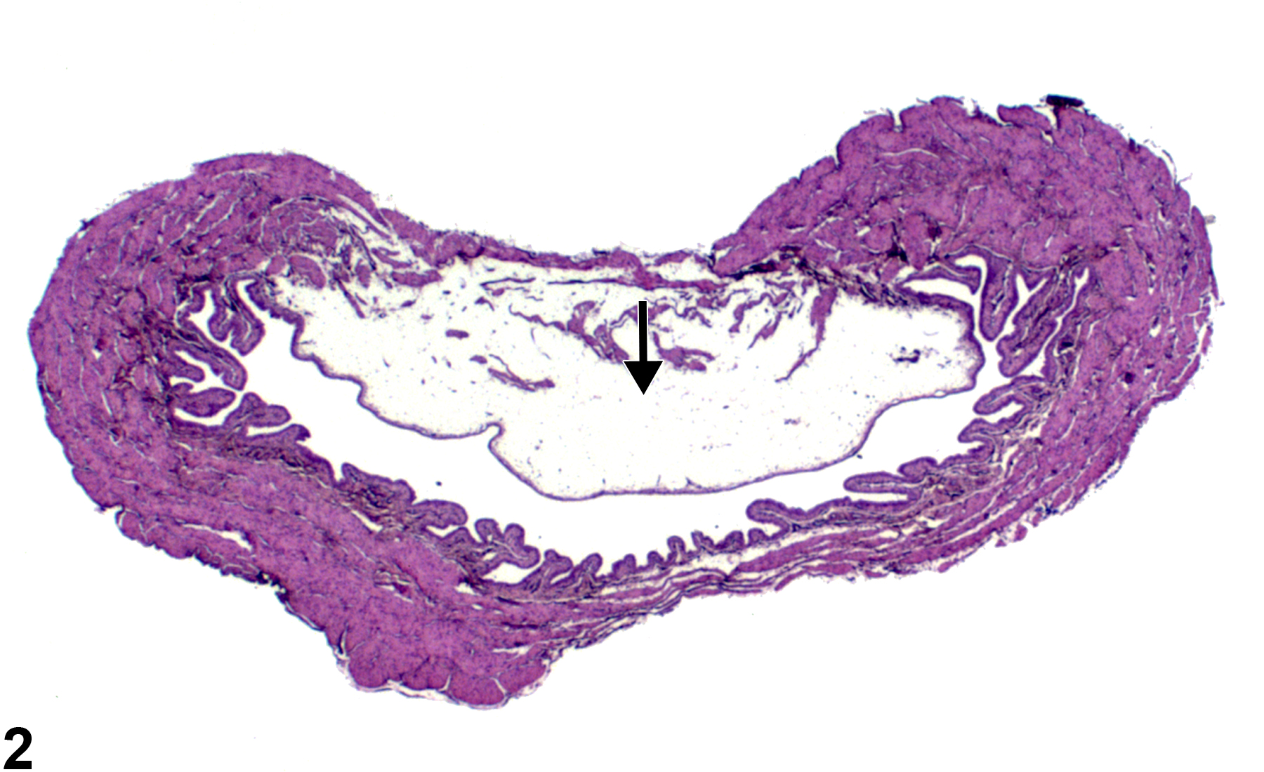 Image of edema in the urinary bladder from a female F344/N rat in an acute study
