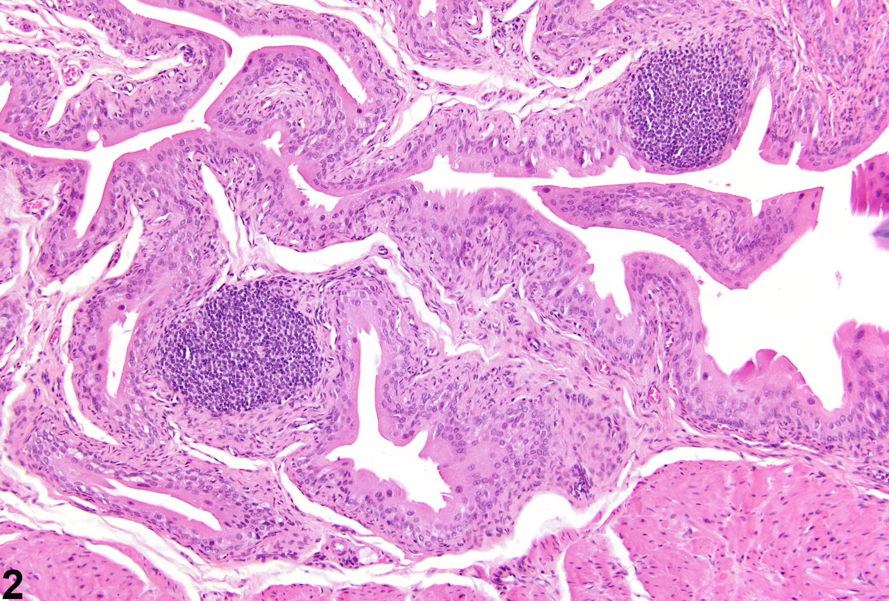 Image of infiltrative cellular, lymphocyte in the urinary bladder from a female B6C3F1 mouse in a chronic study