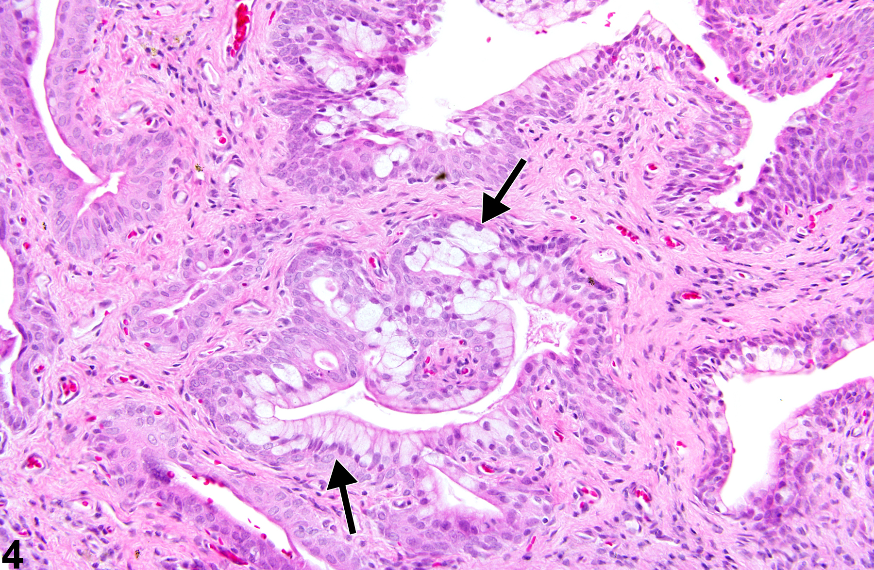 Image of metaplasia in the urinary bladder from a female F344/N rat in a chronic study