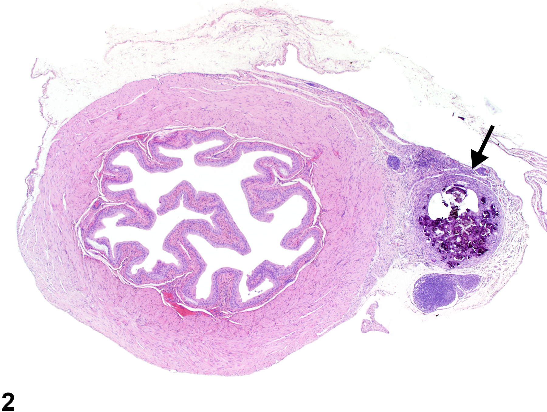 Image of mineralization in the urinary bladder from a female B6C3F1 mouse in a subchronic study