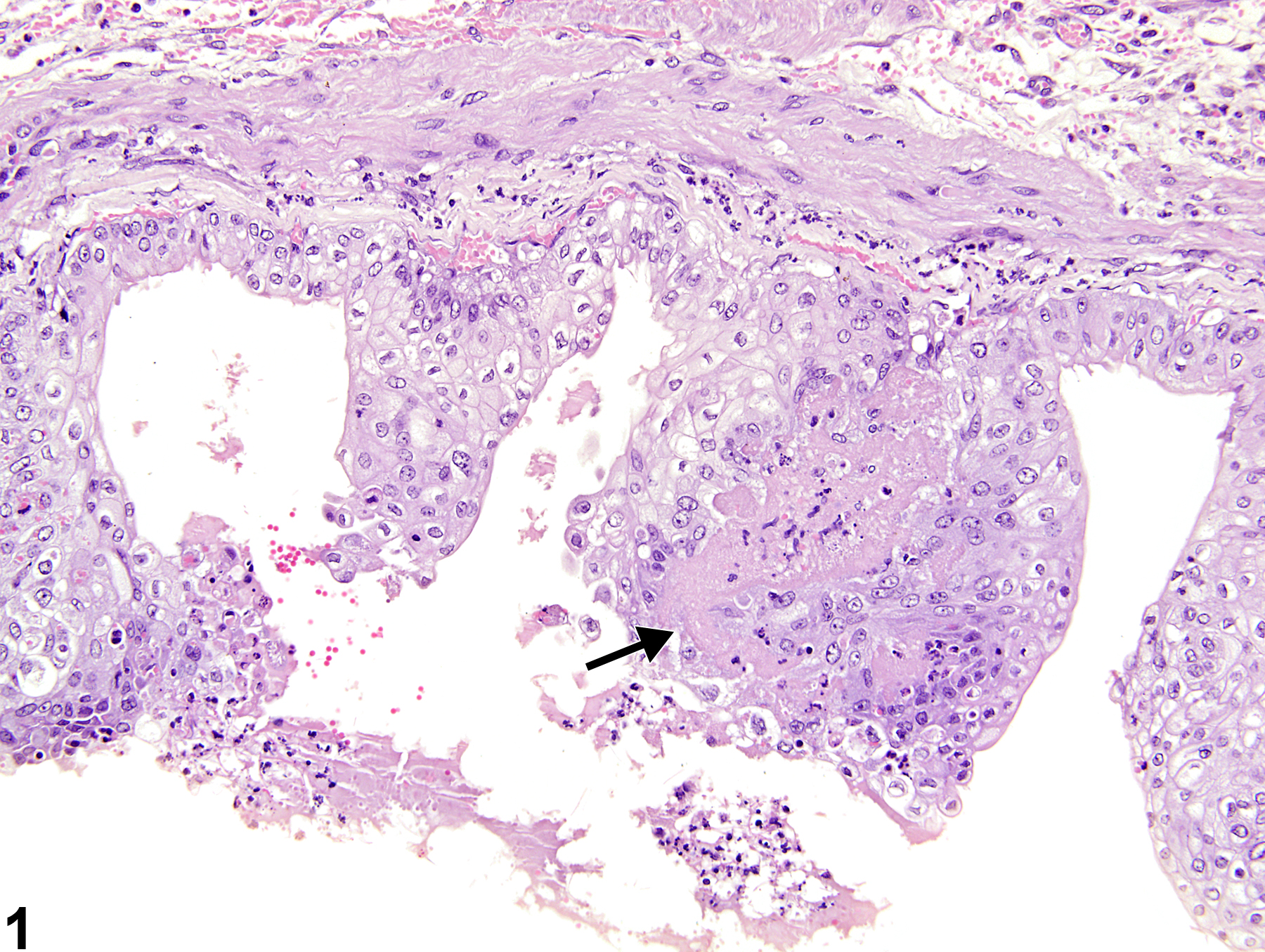 Image of necrosis in the urinary bladder from a male F344/N rat in a chronic study