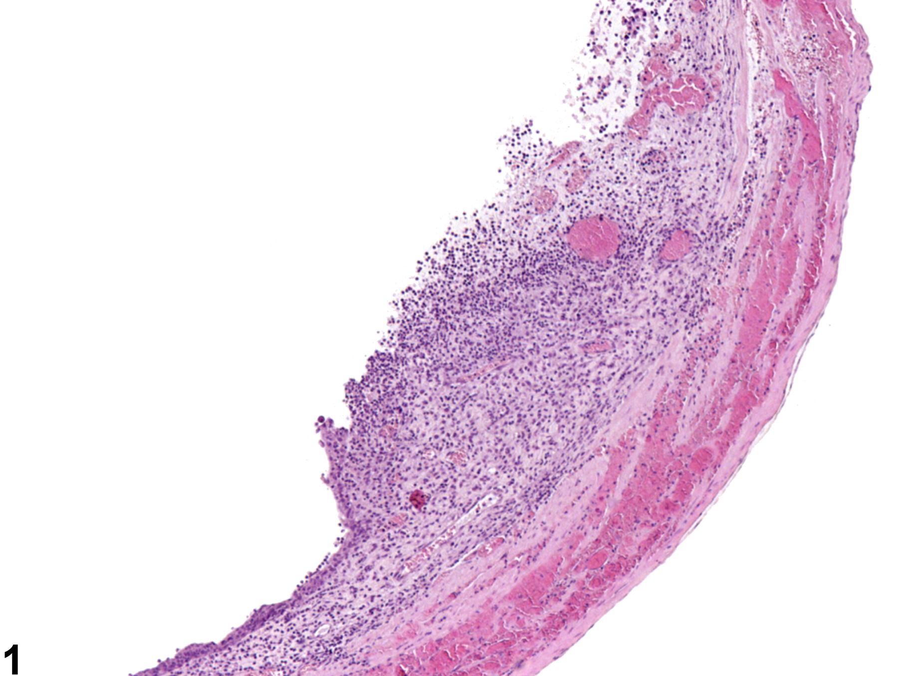 Image of ulcer in the urinary bladder from a male B6C3F1 mouse in a chronic study