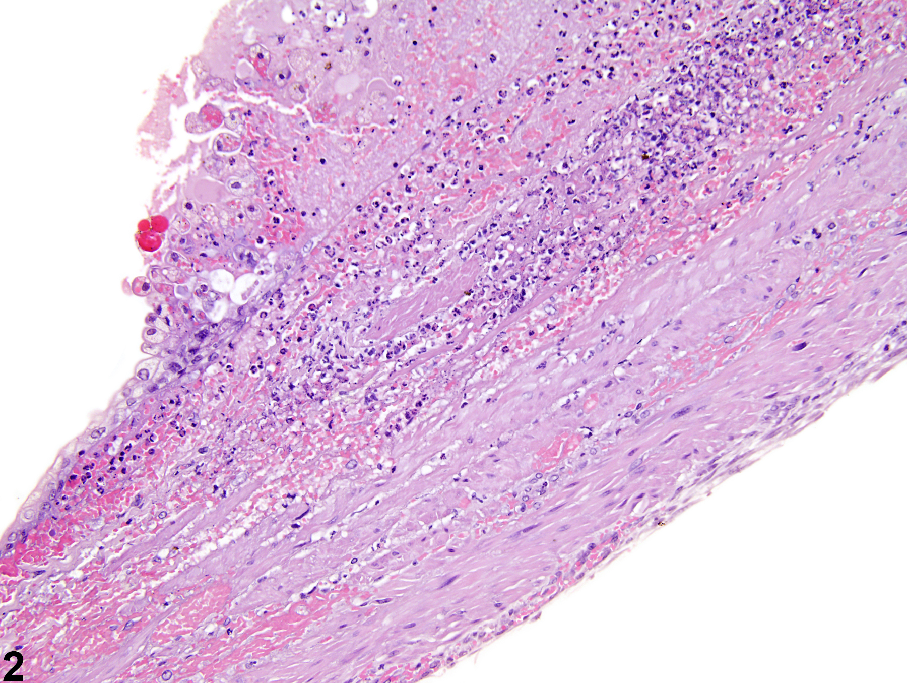 Image of ulcer in the urinary bladder from a male F344/N rat in a chronic study
