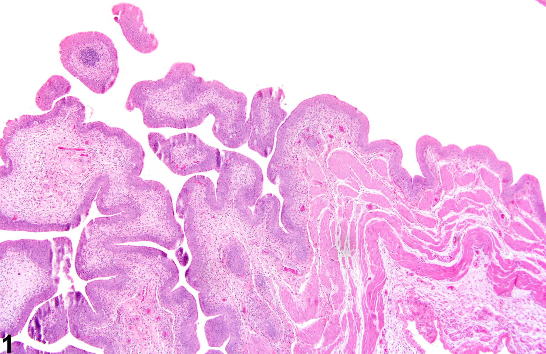 Image of hyperplasia in the urinary bladder from a male F344/N rat in a chronic study