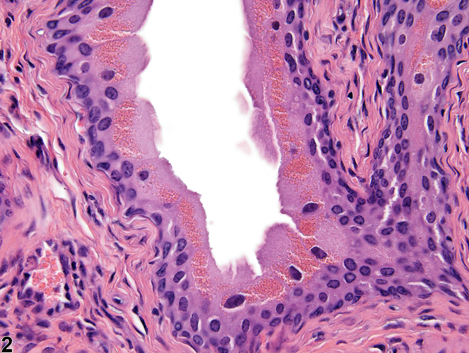 Image of cytoplasmic granules in the urinary bladder from a male B6C3F1 mouse in a subchronic study