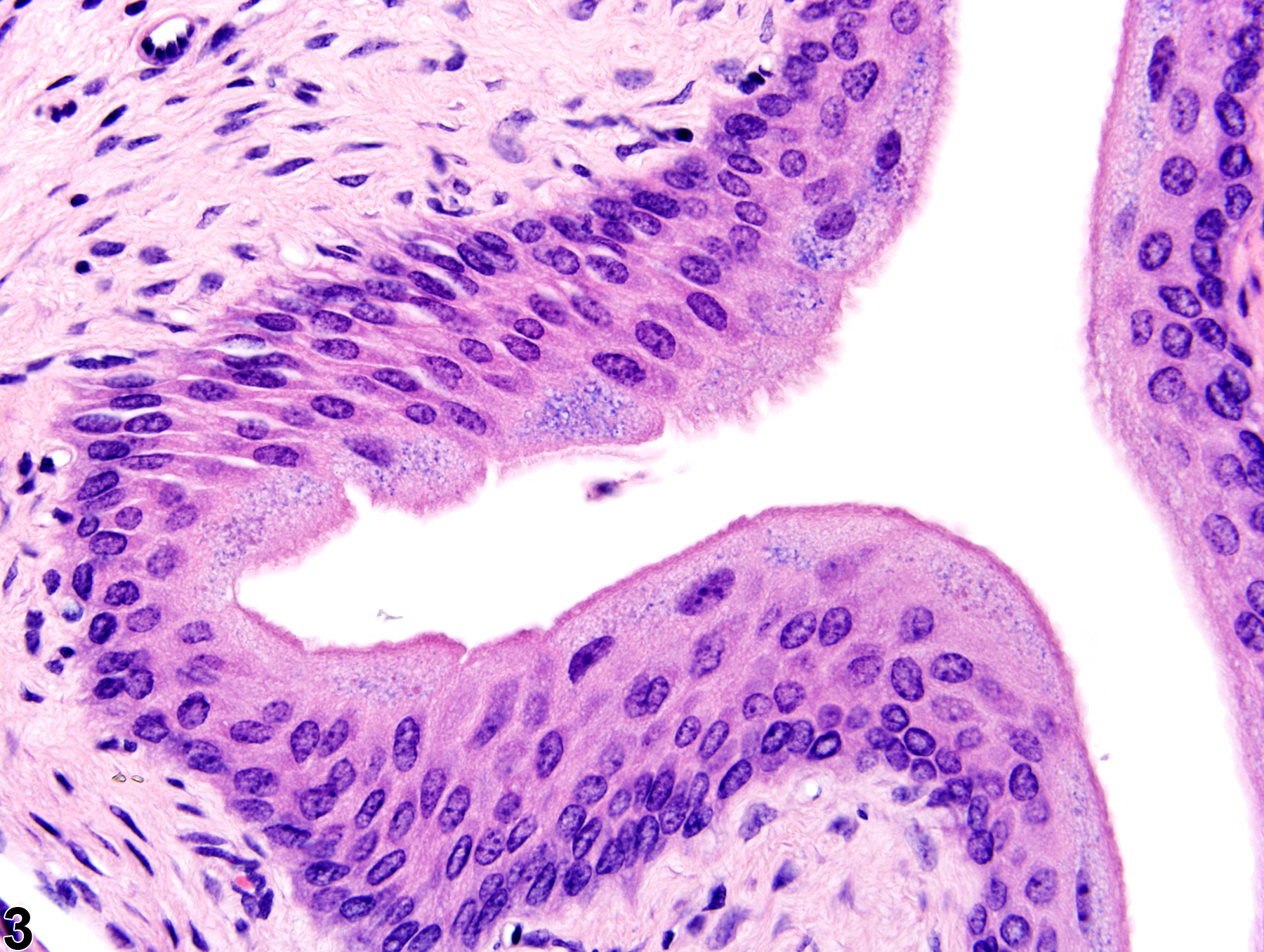 Image of cytoplasmic granules in the urinary bladder from a male B6C3F1 mouse in an acute study