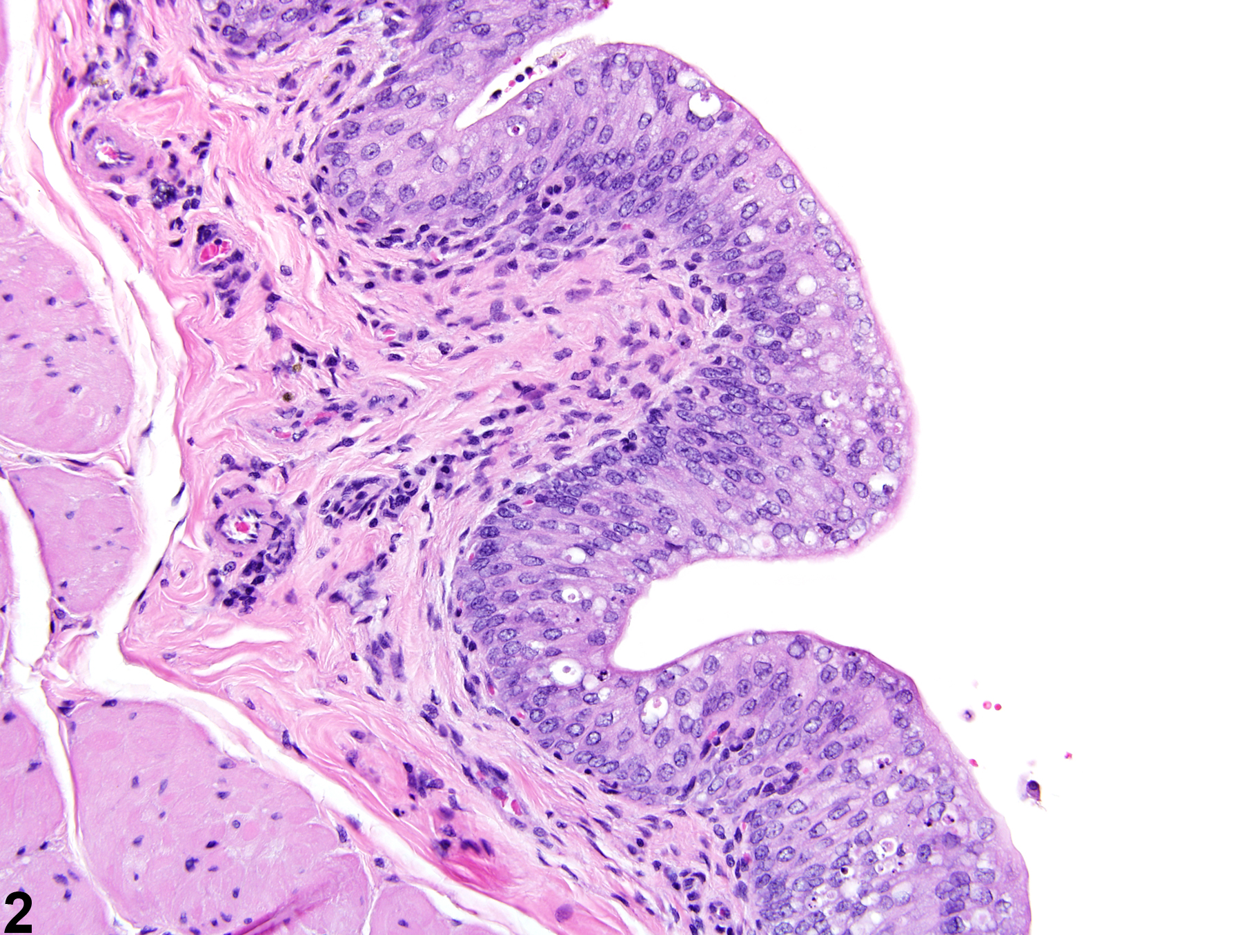Image of vacuolization, cytoplasmic in the urinary bladder from a female Harlan Sprague-Dawley rat in a chronic study
