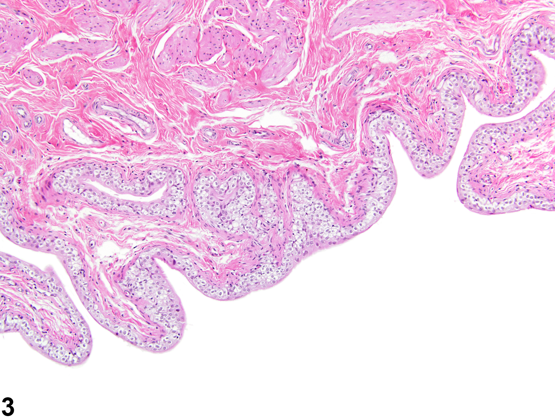 Image of vacuolization, cytoplasmic in the urinary bladder from a male F344/N rat in a chronic study