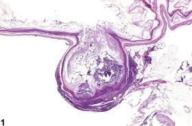 Image of diverticulum in the forestomach from a female B6C3F1 mouse in a chronic study