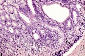 Image of metaplasia, intestinal in the glandular stomach from a male F344/N rat in a chronic study