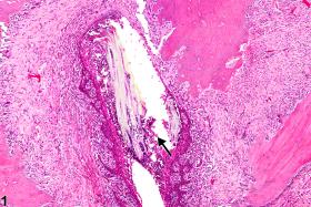 Image of foreign body in the oral mucosa from a male F344/N rat in a chronic study