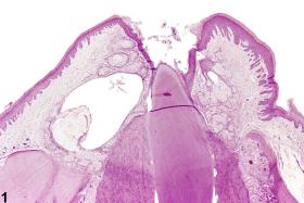 Image of ectopic tissue in the oral mucosa gingiva from a male F344/N rat in a chronic study