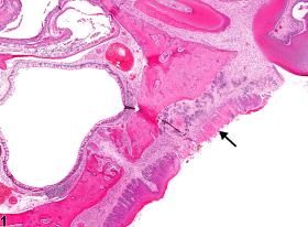 Image of necrosis in the oral mucosa from a male F344/N rat in a subchronic study