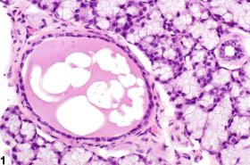 Image of cyst in the salivary gland duct from a female B6C3F1 mouse in a chronic study