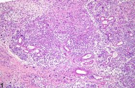 Image of inflammation in the salivary gland from a male F344/N rat in a subchronic study
