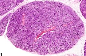Image of karyomegaly in the salivary gland from a male B6C3F1 mouse in a chronic study