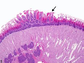 Tongue, Epithelium - Hyperplasia - Nonneoplastic Lesion Atlas