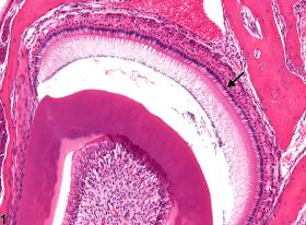 Image of normal ameloblast comparison to atrophy in the tooth from a male B6C3F1 mouse in a chronic study