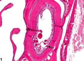Image of angiectasis in the tooth from a male F344/N rat in a chronic study