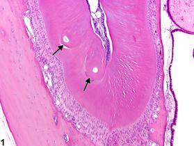 Image of denticle in the tooth from a male B6C3F1 mouse in a chronic study