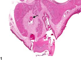 Image of fibrosis in the tooth from a female HSD rat in a chronic study