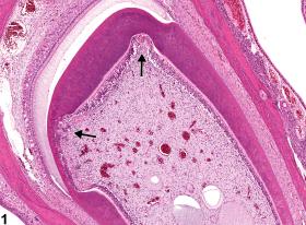 Image of degeneration in the tooth from a female HSD rat in a subchronic study