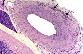Image of pigment in the mesentery, artery from a male F344/N rat in a chronic study