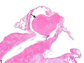 Image of thrombus in the heart, atrium from a male Swiss Webster mouse in a chronic study