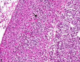 Image of inflammation in the adrenal gland cortex from a female B6C3F1/N mouse in a chronic study