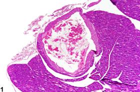 Image of cyst in the pancreatic islet from a male B6C3F1 mouse in a chronic study