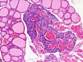 Image of angiectasis in the parathyroid gland from a male BALB/c mouse in a subchronic study
