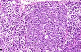 Pituitary Gland - Hyperplasia - Nonneoplastic Lesion Atlas