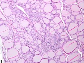 Image of C cell hyperplasia in the thyroid gland from a female F344/N rat in a chronic study