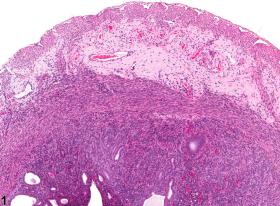 Image of amyloid in the uterus from a female Swiss Webster mouse in a chronic study